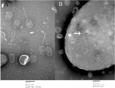 Electron Micrographs Of Vibrio Phage R A And Phage Absorption