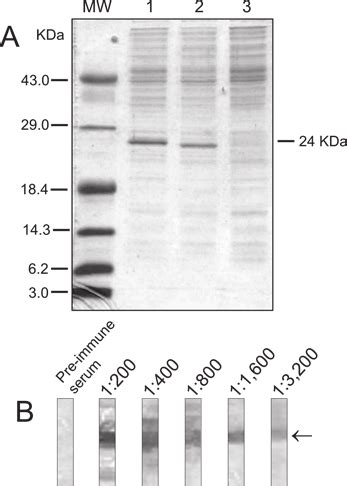 A Ferritin Expression In E Coli BL21 DE3 Following IPTG Induction