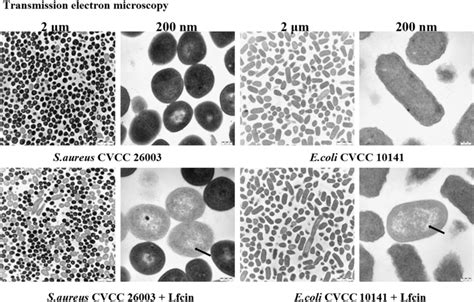 Transmission Electron Microscopy Display Of The Antibacterial Activity