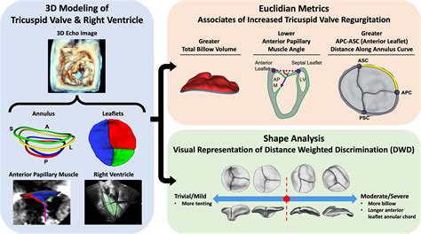 Modeling Of The Tricuspid Valve And Right Ventricle In Hypoplastic Left