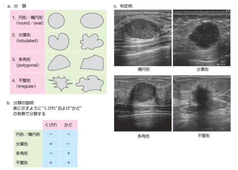 乳がん検診の乳腺エコーとは？マンモグラフィとの違いと結果の見方