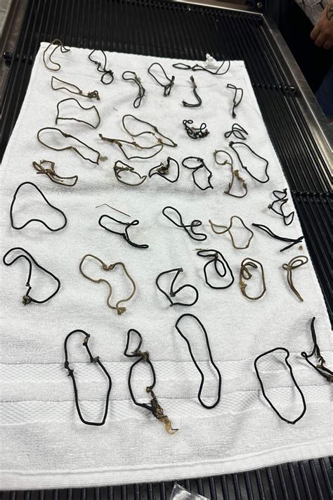 Vet's shocking discovery in sick cat's stomach: 'I've never seen