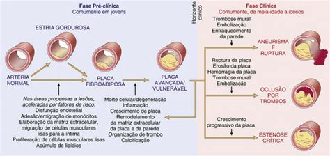 Fisiopatologia O Que E Braincp