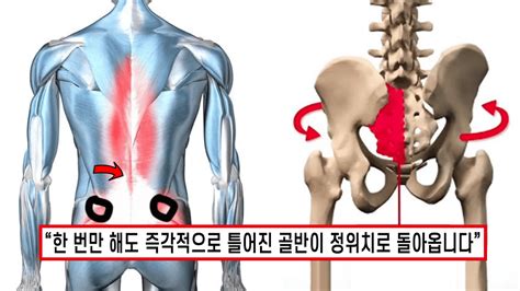 진짜 전후 차이가 확실함 5분만 따라해도 꽈배기처럼 뒤틀린 골반 바로 잡아주는 자세 교정법 최고의 인생