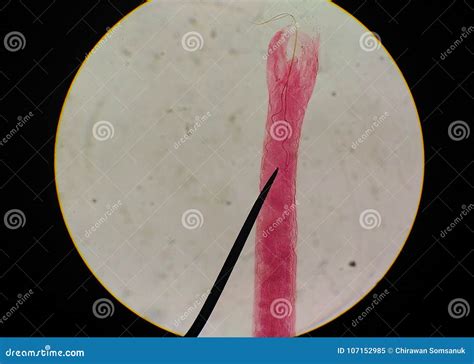 Close Up Egg with Adult of Parasite. Stock Image - Image of meat ...