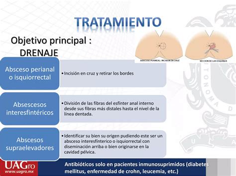 Fisura Absceso Y Fistula Anal Ppt