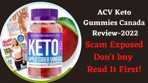 Warning Acv Keto Gummies Canada Review Scam Alert You Need To