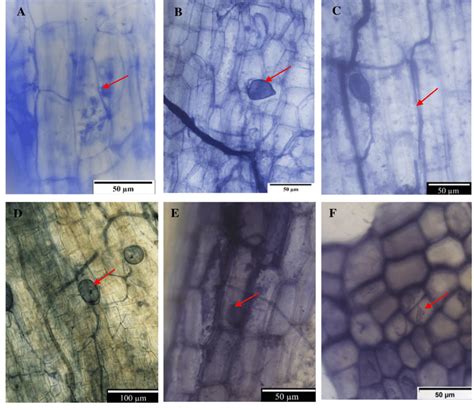 Micrographs Of Trypan Blue Stained Roots Taken With An Olympus Dp