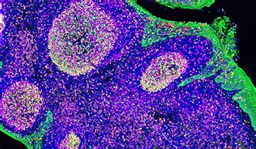 Opal Multiplex Ihc Kits Tsa Reagents And Assays Akoya Biosciences