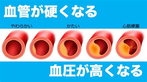 血圧と血管｜田園都市高血圧クリニック かなえ｜横浜市青葉区の内科・循環器内科