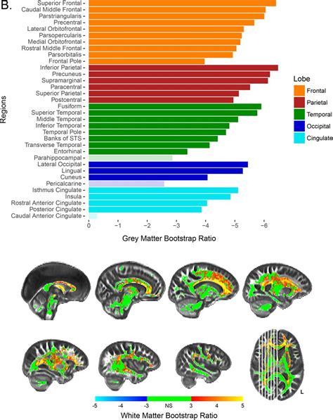 Visual Studio 2015 Grey Matter