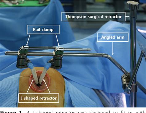 Figure 1 From Comparison Of General Anesthesia And Combined Spinal And