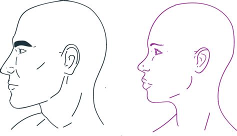 Prominent Supraorbital Ridge