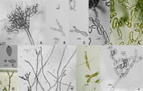 Cladosporium Macrocarpum Preuss A J Micromorphology Of Conidiophores