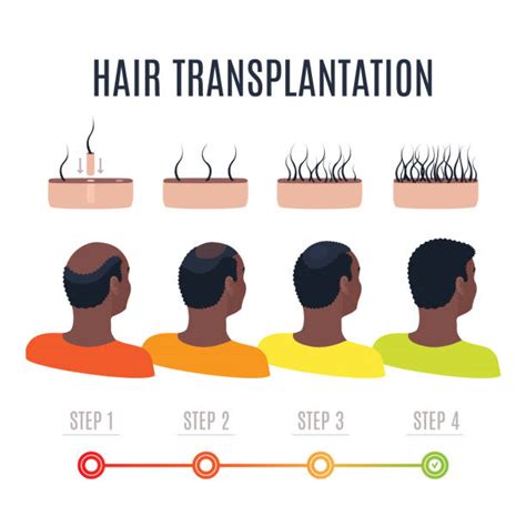 Hair Transplant Icon Illustrations Royalty Free Vector Graphics And Clip