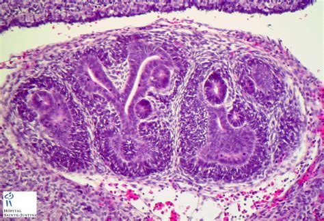 Embryonic Kidney Human Pathology