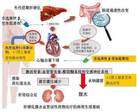 壹生资讯 肝硬化伴顽固性腹水患者，如何正确使用收缩血管活性药物？