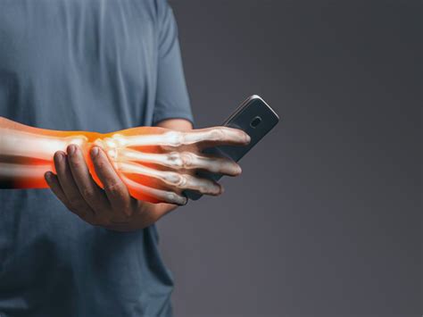 Carpal Tunnel Syndrome Treatment Perea Clinic