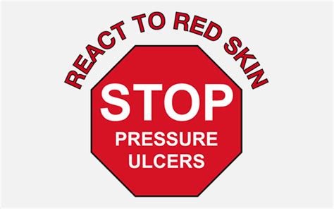 Stop the pressure! A simplified Guide to Pressure Ulcer Prevention and Pressure Ulcer Management ...