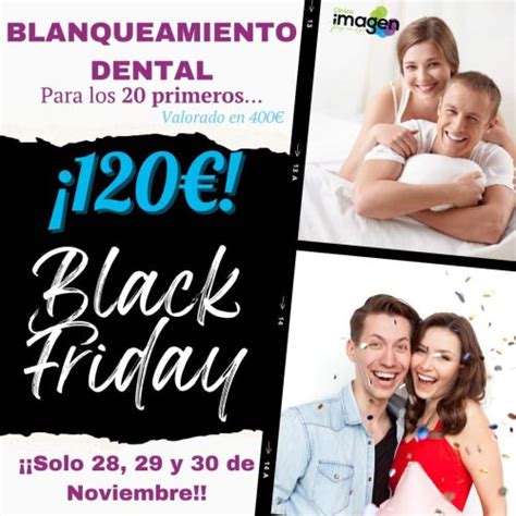 Blanqueamiento dental Clínica Imágen Sevilla