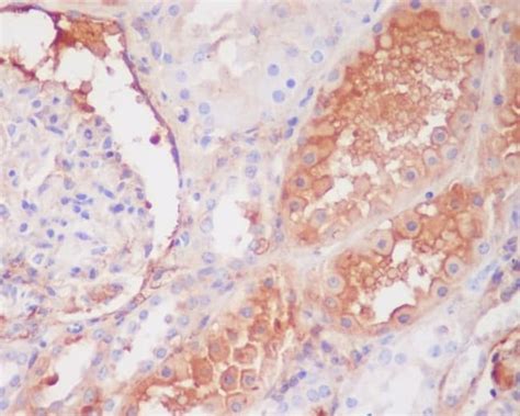 Complement Component C9 Antibody SR2144 Novus Biologicals 50 μg