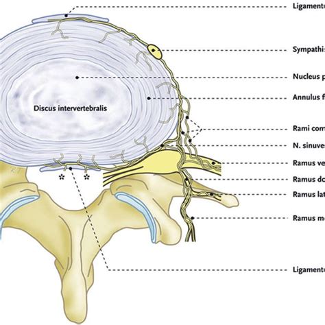 Discography At 3 Levels L3 L4 L4 L5 And L5 S1 All In Anteroposterior Download Scientific