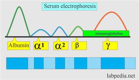 Immunoglobulin Electrophoresis Immunoglobulins Pattern In Various