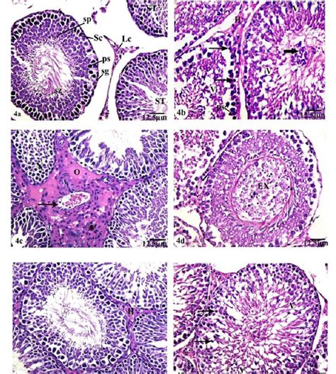 Photomicrographs Of Section In The Testis Of Rat Stained With Hande A