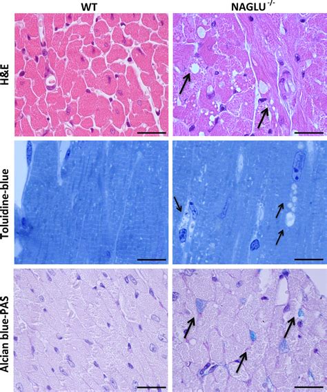 Histological Analysis Of Myocardial Vacuolization Representative H E