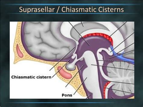 Ppt Brain Cisterns Powerpoint Presentation Id2263744