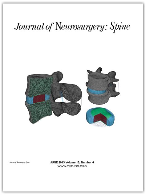 Instantaneous Center Of Rotation Behavior Of The Lumbar Spine With