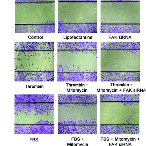 FAK expression is essential for thrombin induction of RPE cell ...