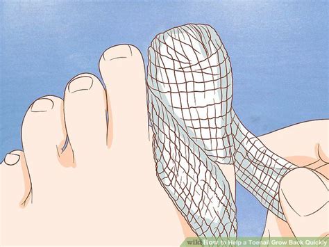 How To Help A Toenail Grow Back Quickly Steps With Pictures Artofit