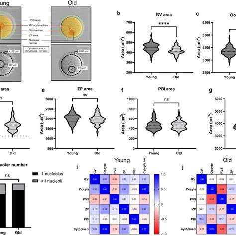 Baseline Morphokinetic Parameters Of Meiotic Progression In