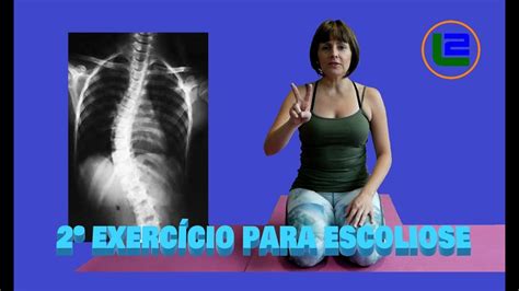 ESCOLIOSE EXERCÍCIOS SIMPLES QUE FUNCIONAM PARTE 2 YouTube