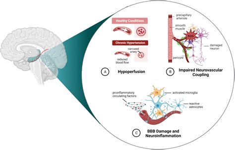 Hippocampal Vascular Supply And Its Role In Vascular Cognitive