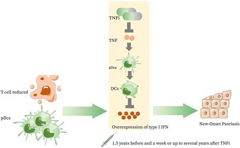 Tumor Necrosis Factor Inhibitorassociated Psoriasis Facts And