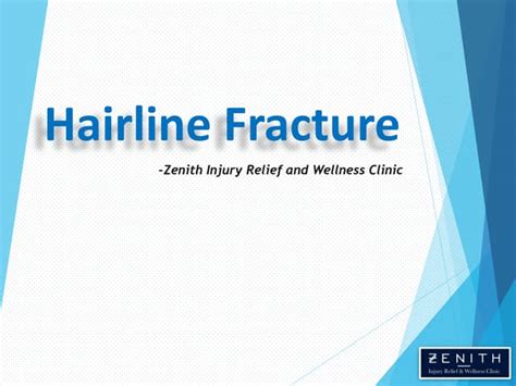 Hairline Fracture Causes Symptoms And Treatment