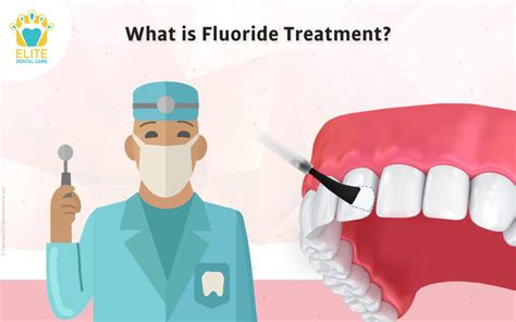 What Is Fluoride Treatment Elite Dental Care