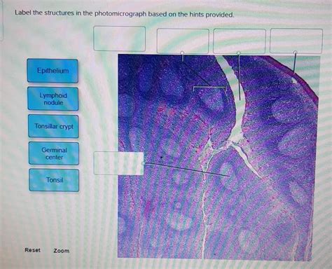 Solved Label The Structures In The Photomicrograph Based On Chegg