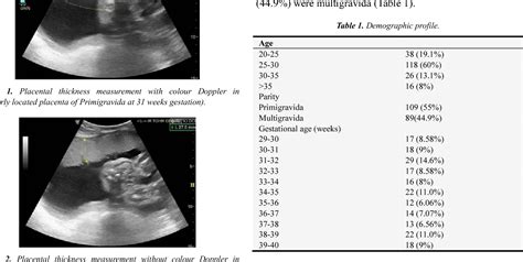 Table From Accuracy Of Ultrasonographically Measured Placental