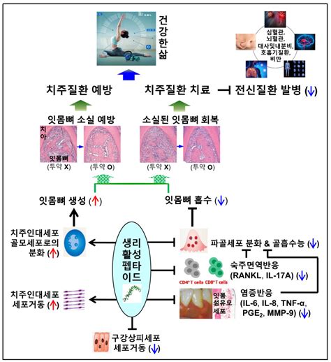 국내 연구진 치주질환 치료한계 극복 약물 개발 가능성 제시 전자신문