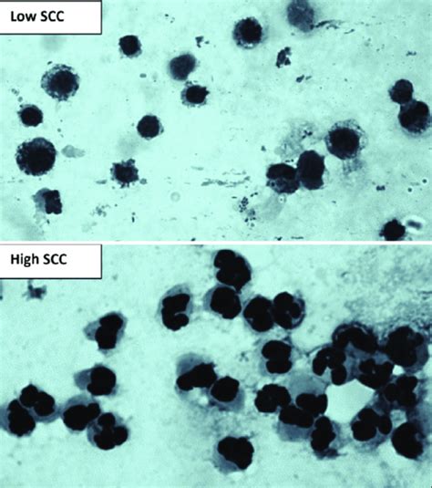 Figure 4 Microscopic Examination Of Milk Somatic Cells Smear Showing