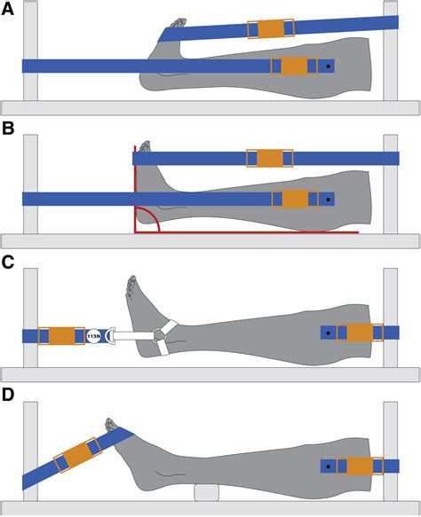 Maximum Ankle Plantarflexion And Dorsiflexion Allow For Optimal