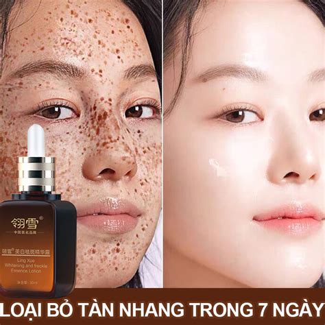 Serum Chống Lão Hóa