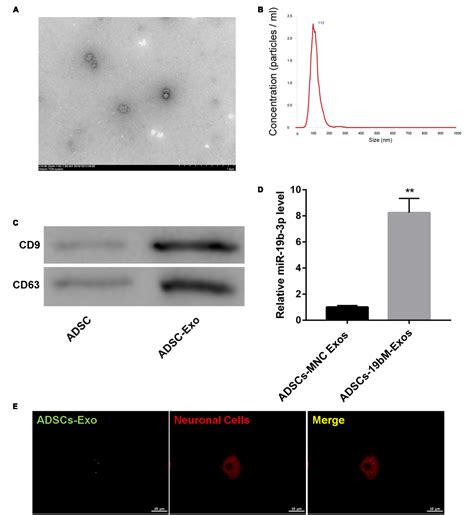 Exosomes From MiR 19b 3p Modified ADSCs Inhibit Ferroptosis In