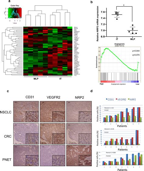 Nrp Expression Is Positively Correlated With Pnet Vascularity A