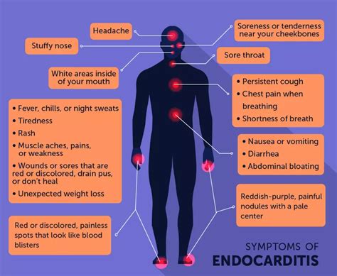 Endocarditis Symptoms Testing And Treatment Myheartdiseaseteam