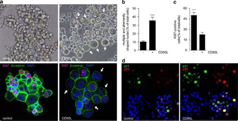 Cd95 Ligand Induces Senescence In Mismatch Repair Deficient Human Colon