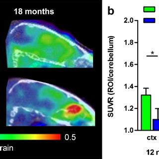 Comparison Of Antibody And Pib Pet Imaging A Sagittal View Of Pet